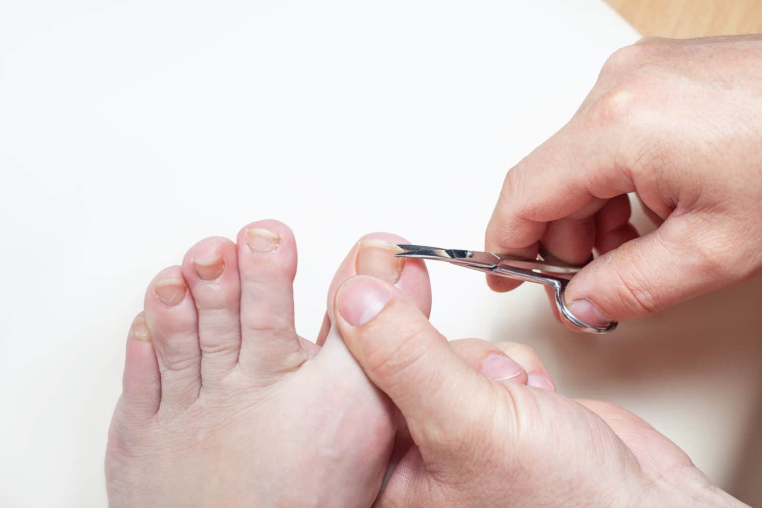 How To Stop Ingrown Toenails Prevention And Treatment Tips