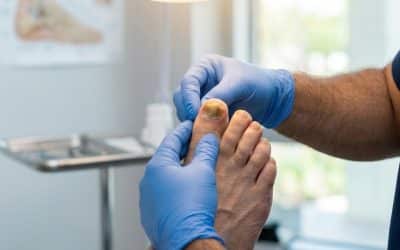 10 Common Foot Problems You Should Never Ignore