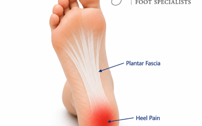 What’s the Difference Between Heel Pain and Plantar Fasciitis?