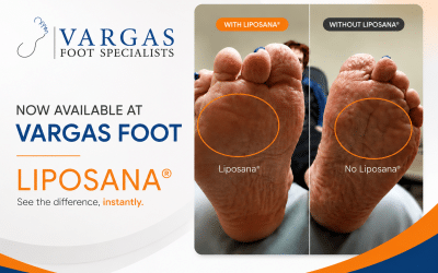 Liposana Fat Pad Augmentation: A New Option for Foot Pain Relief in Sugar Land