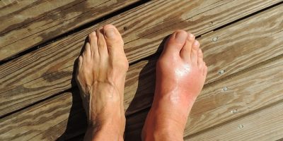 Gout